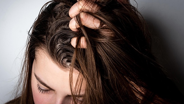 Cách trị mồ hôi dầu trên tóc bằng Vitamin B1